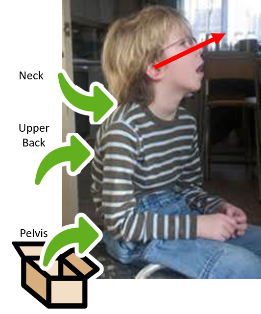 This photo shows a boy sitting with a rounded back. His neck is hyper-extended and his mouth is hanging open